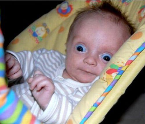 Ugly Baby Pictures 18