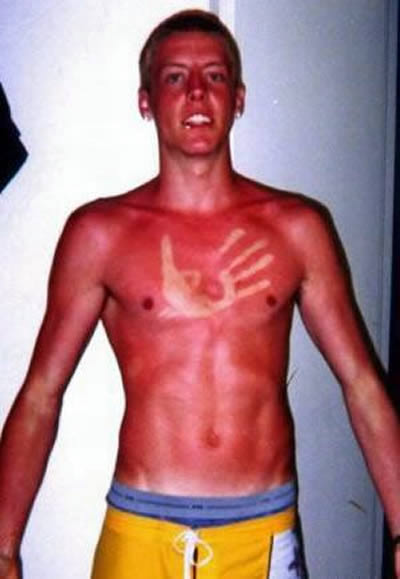 Funny sun tan!